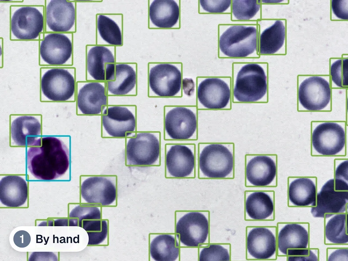 A blood smear where every red blood cell has a full frame drawn by a person