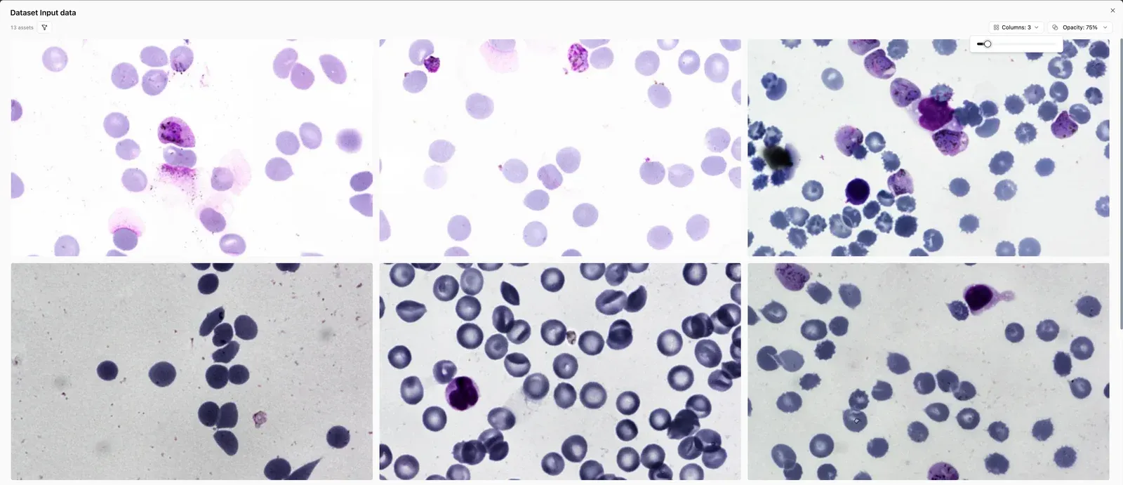 A grid of blood smear images in the Input data dataset: different stains, many small round cells per image