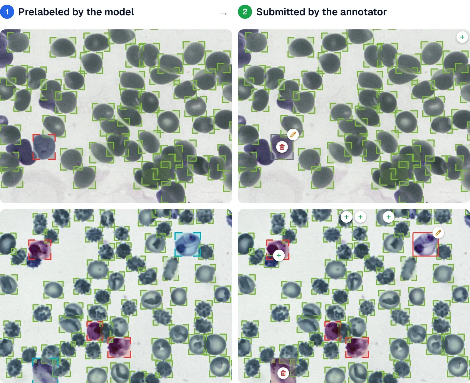 Two blood smears, each shown twice: on the left with the model's boxes, on the right as the annotator submitted them, with a few added, deleted or fixed boxes marked by badges
