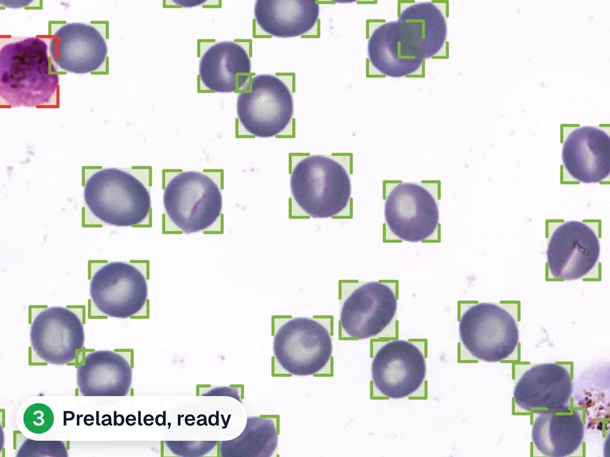 A blood smear where every red blood cell was marked by the model and nothing was changed