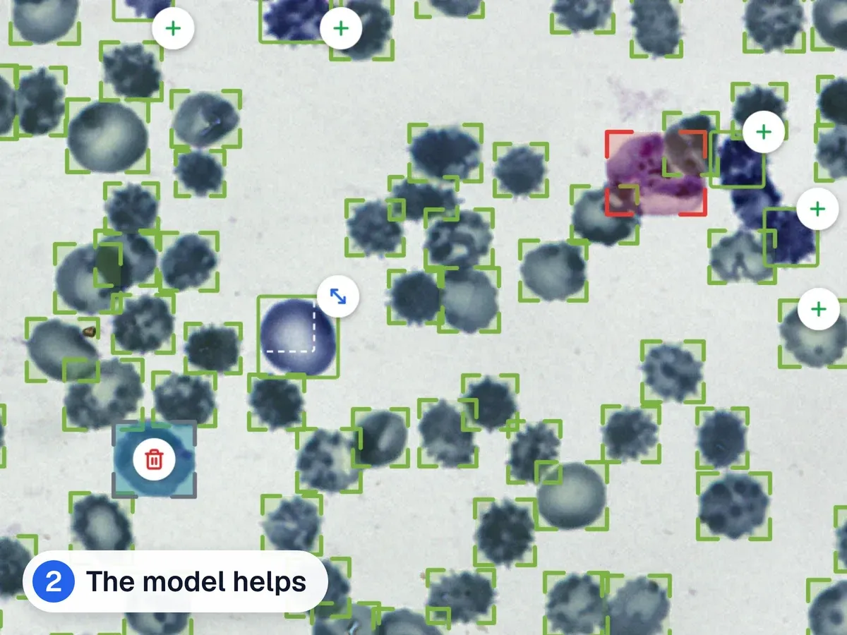 A blood smear where the model marked almost every red blood cell. The annotator added a few missed cells, deleted one extra box and resized one box; each change has a badge.